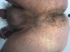 My hairy bum