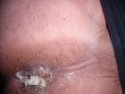 My butthole with pee diaper goof my girlfriend put in