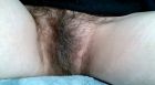 Hairy-1