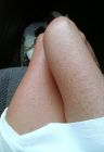 caro's legs