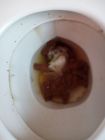 Toilet poop