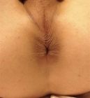 Lovely Hole (5)