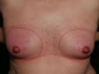 Tits and Nipple Tortur 2.017