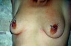 tortured nipples