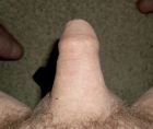 little_firm_top_foreskin