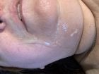 LAURIE FACIAL CUM