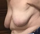 74 YO Tits