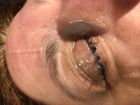 LAURIE CUM IN EYE