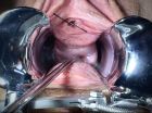 Speculum play